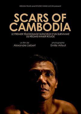 ScarsofCambodia